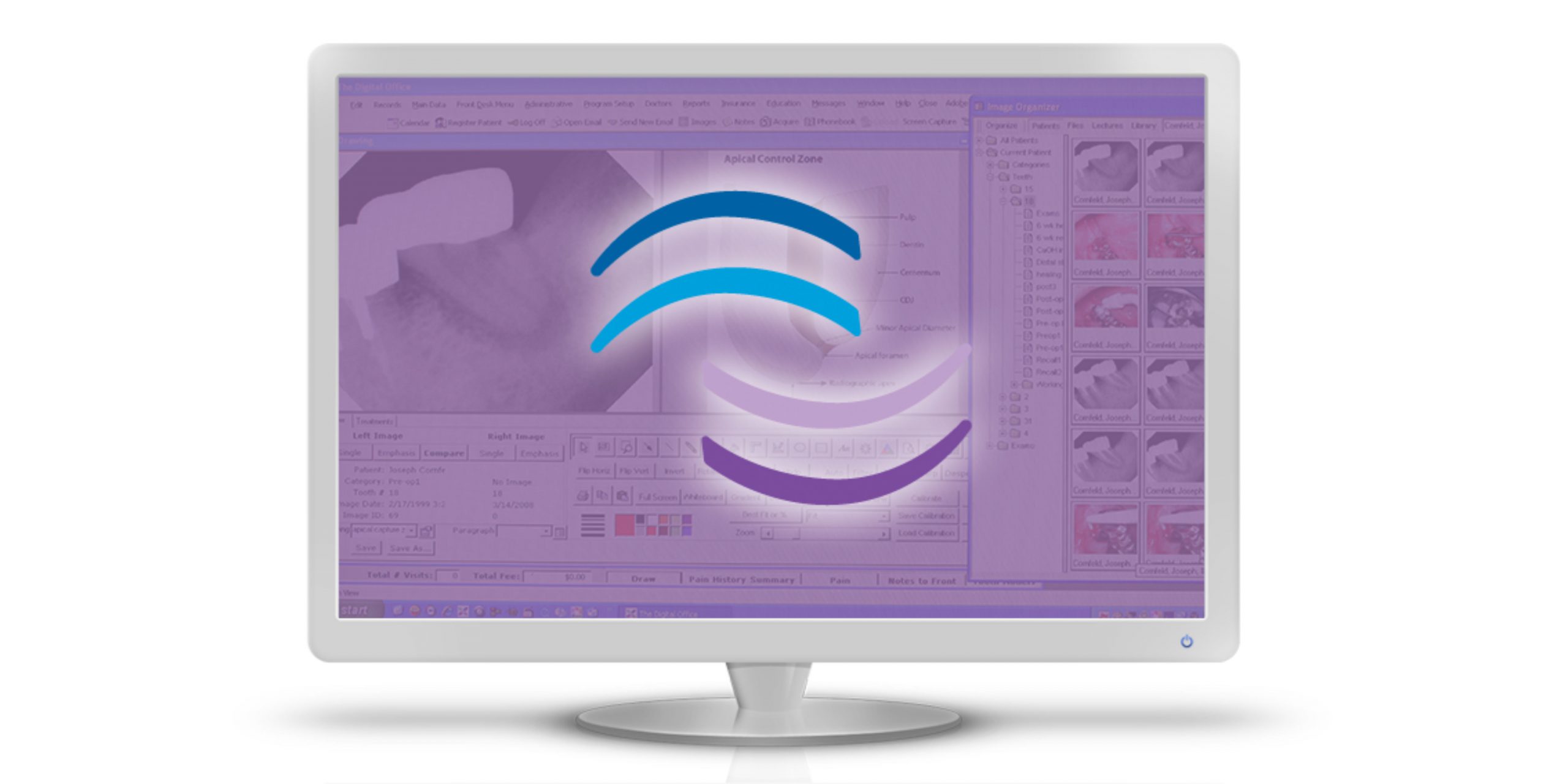 tdo software